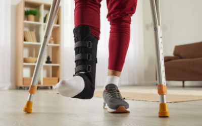 Should I Wear An Ankle Brace All Day After Surgery