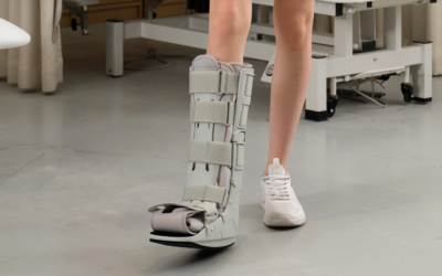 How Long To Wear A Walking Boot For A Sprained Ankle?